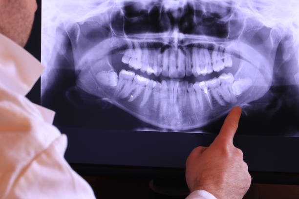 Best Emergency Root Canal Treatment in Willow Springs, MO